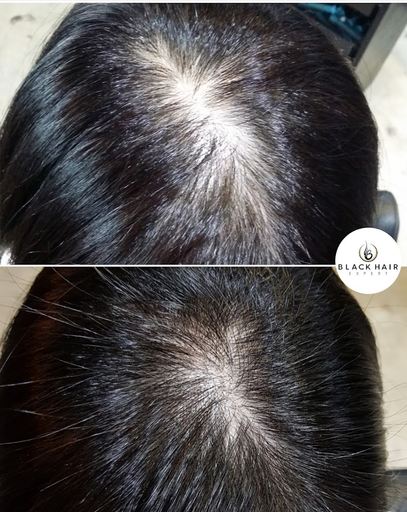 Black Hair Expert (Butterworth) logo
